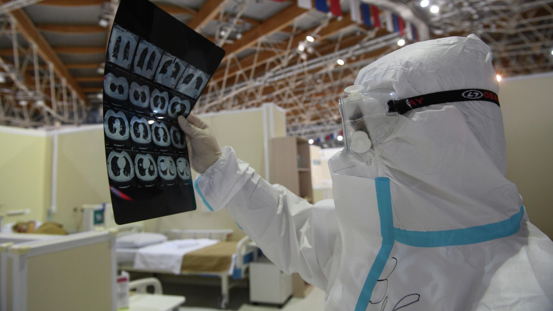 Новому симптому коронавируса нашли объяснение Новому симптому коронавируса нашли объяснение