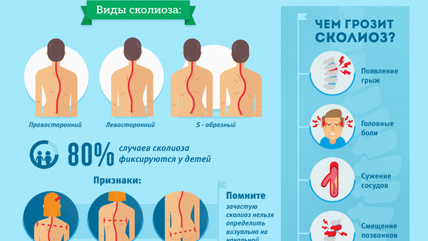 сколиоз сколиоз