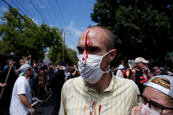 Мужчина, пострадавший во время столкновений ультраправых и их противников в Шарлоттсвилле, штат Вирджиния Мужчина, пострадавший во время столкновений ультраправых и их противников в Шарлоттсвилле, штат Вирджиния