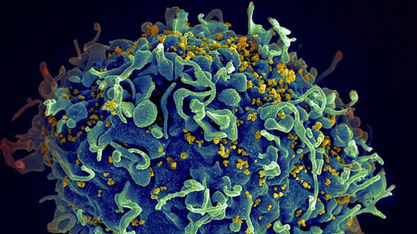 Ученые сообщили о третьем вероятном пациенте в мире, излечившемся от ВИЧ