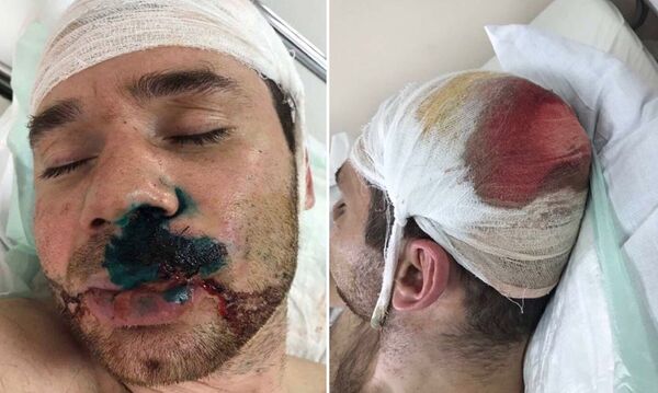 Несколько пуль попало в голову Несколько пуль попало в голову