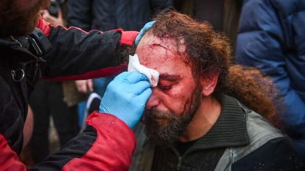 В Афинах в ходе протестов пострадал стрингер агентства Sputnik. 20.01.2019
В Афинах в ходе протестов пострадал стрингер агентства Sputnik. 20.01.2019
