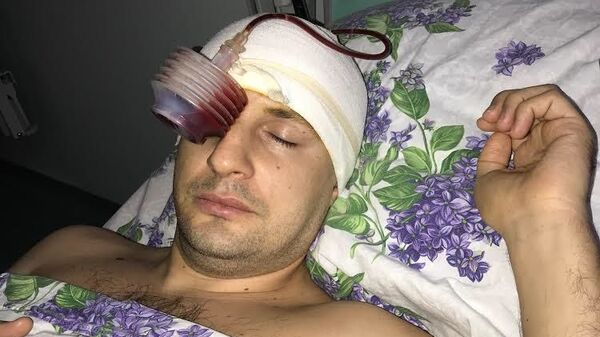 Инал 11 дней провел в коме Инал 11 дней провел в коме