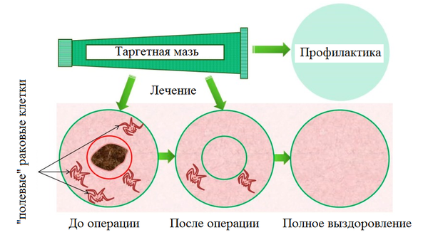 Схематическое изображение эффекта от применения подхода Схематическое изображение эффекта от применения подхода