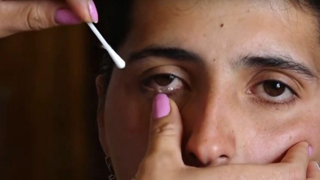 Image result for Врач-офтальмолог объяснила, почему девушка из Армении плачет кристаллами
