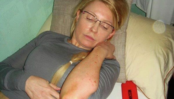 Юлия Тимошенко демонстрирует синяки на теле Юлия Тимошенко демонстрирует синяки на теле