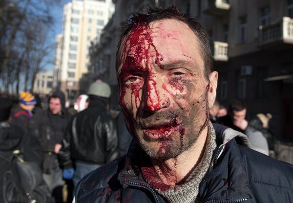 Пострадавший в ходе беспорядков в Киеве Пострадавший в ходе беспорядков в Киеве